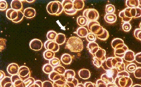 microzymas et cellules